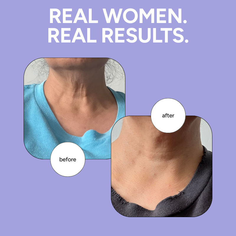 Tighten & Lift – Skin-Firming Cream for Neck & Décolleté