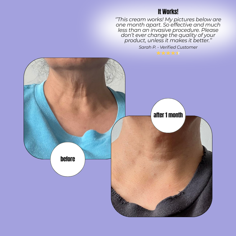 Tighten & Lift – Skin-Firming Cream for Neck & Décolleté