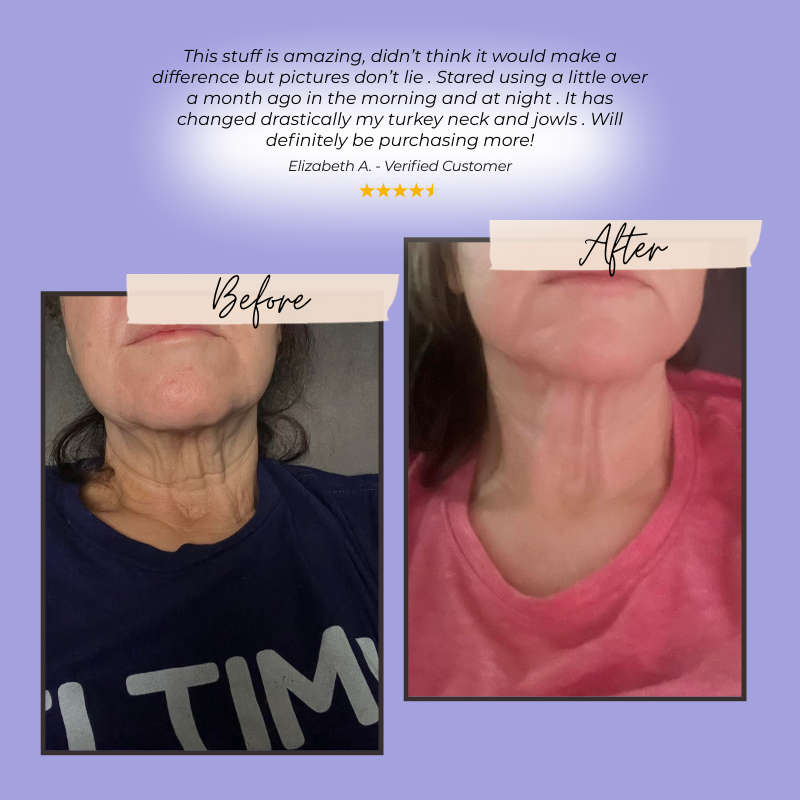 Tighten & Lift – Skin-Firming Cream for Neck & Décolleté